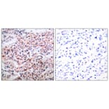 Immunohistochemistry - BCL-2 (Phospho-Thr56) Antibody from Signalway Antibody (11064) - Antibodies.com