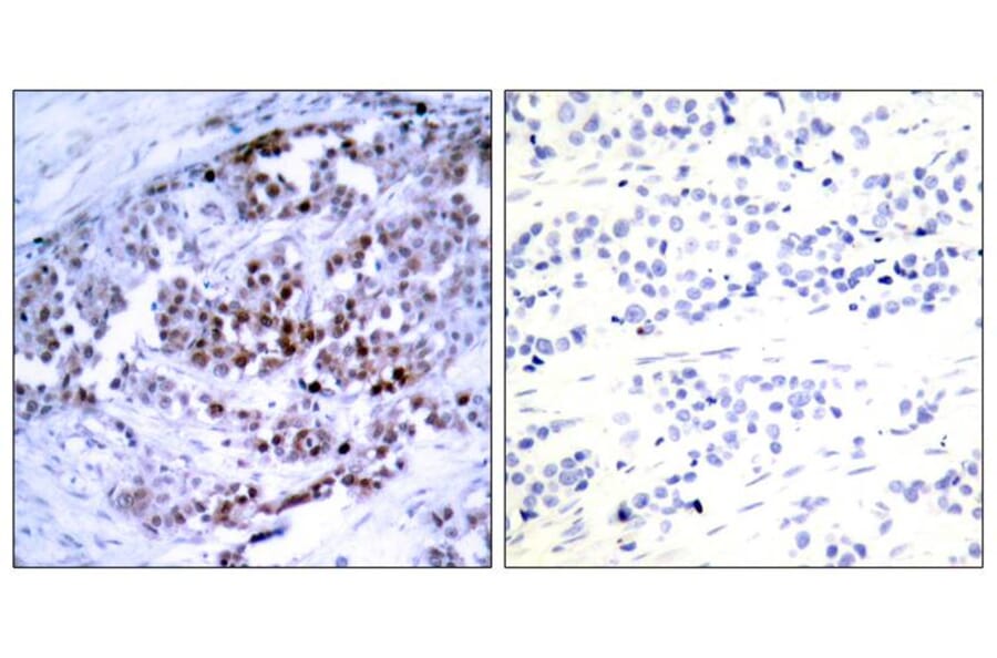 Immunohistochemistry - BCL-2 (Phospho-Ser70) Antibody from Signalway Antibody (11065) - Antibodies.com