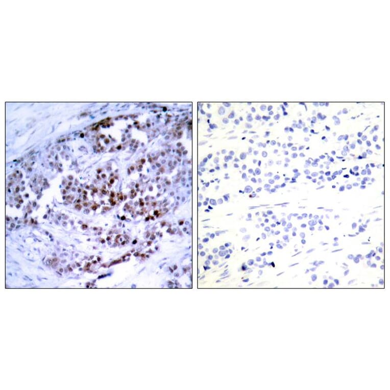 Immunohistochemistry - BCL-2 (Phospho-Ser70) Antibody from Signalway Antibody (11065) - Antibodies.com