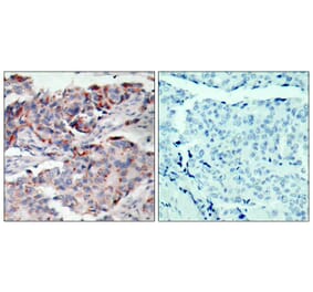 Immunohistochemistry - JAK2 (Phospho-Tyr221) Antibody from Signalway Antibody (11150) - Antibodies.com