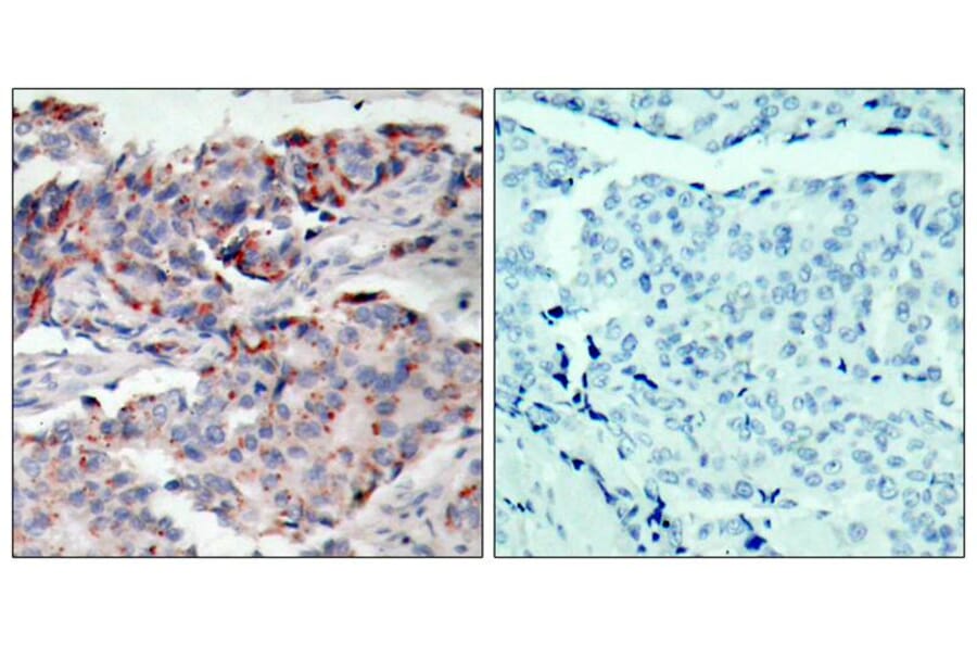 Immunohistochemistry - JAK2 (Phospho-Tyr221) Antibody from Signalway Antibody (11150) - Antibodies.com