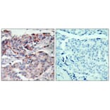 Immunohistochemistry - JAK2 (Phospho-Tyr221) Antibody from Signalway Antibody (11150) - Antibodies.com