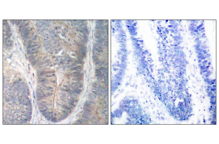 Immunohistochemistry - PKR (Phospho-Thr451) Antibody from Signalway Antibody (11290) - Antibodies.com