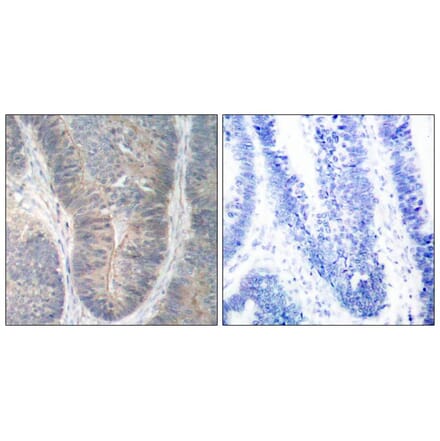 Immunohistochemistry - PKR (Phospho-Thr451) Antibody from Signalway Antibody (11290) - Antibodies.com