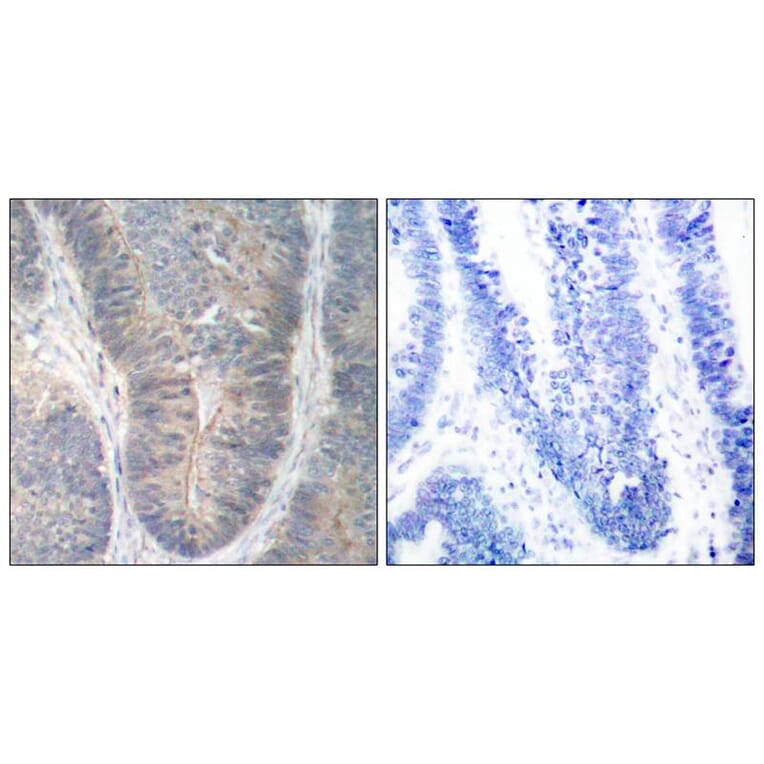 Immunohistochemistry - PKR (Phospho-Thr451) Antibody from Signalway Antibody (11290) - Antibodies.com