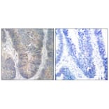 Immunohistochemistry - PKR (Phospho-Thr451) Antibody from Signalway Antibody (11290) - Antibodies.com
