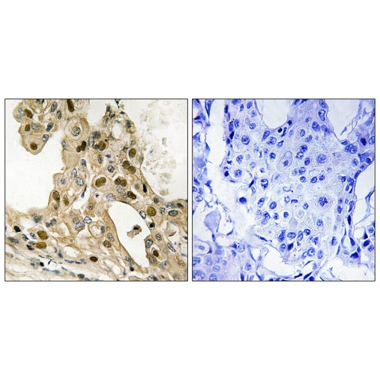 Immunohistochemistry - p53 (Phospho-Thr387) Antibody from Signalway Antibody (11718) - Antibodies.com