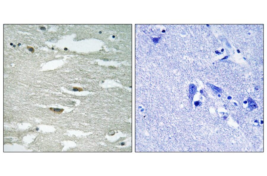 Immunohistochemistry - ILK (Phospho-Ser246) Antibody from Signalway Antibody (11733) - Antibodies.com