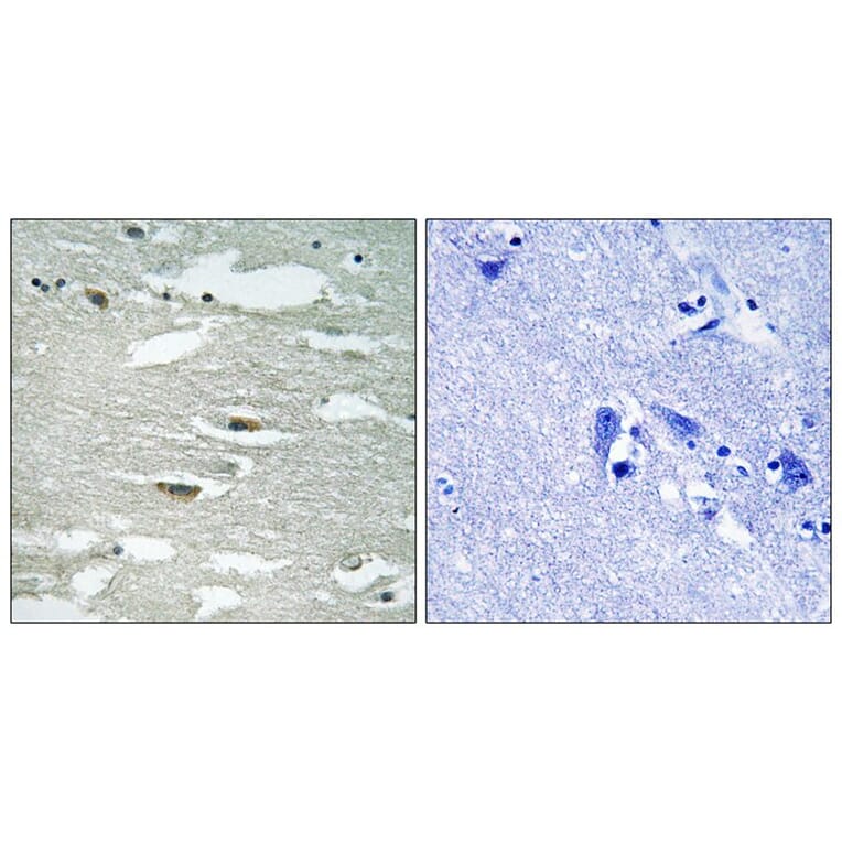 Immunohistochemistry - ILK (Phospho-Ser246) Antibody from Signalway Antibody (11733) - Antibodies.com