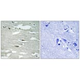 Immunohistochemistry - ILK (Phospho-Ser246) Antibody from Signalway Antibody (11733) - Antibodies.com