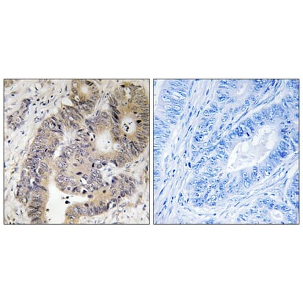 Immunohistochemistry - CAD (Phospho-Thr456) Antibody from Signalway Antibody (11789) - Antibodies.com