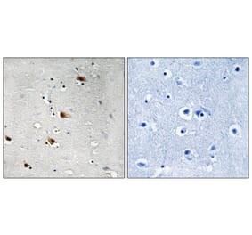 Immunohistochemistry - E2A (Phospho-Thr355) Antibody from Signalway Antibody (11798) - Antibodies.com