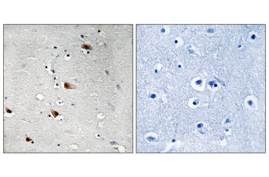 Immunohistochemistry - E2A (Phospho-Thr355) Antibody from Signalway Antibody (11798) - Antibodies.com