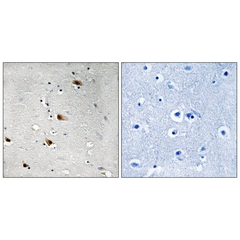 Immunohistochemistry - E2A (Phospho-Thr355) Antibody from Signalway Antibody (11798) - Antibodies.com