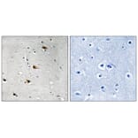 Immunohistochemistry - E2A (Phospho-Thr355) Antibody from Signalway Antibody (11798) - Antibodies.com