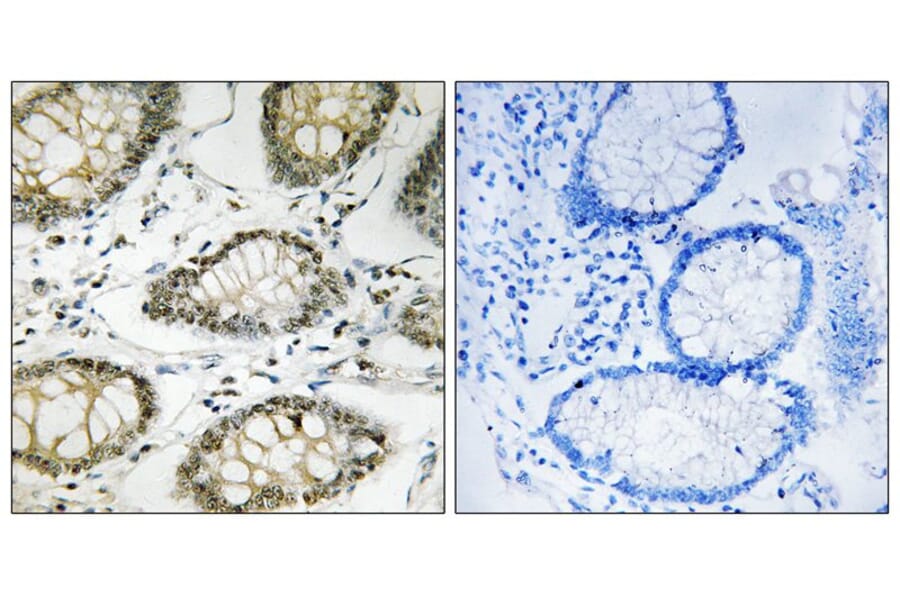 Immunohistochemistry - ATR (Phospho-Ser428) Antibody from Signalway Antibody (12129) - Antibodies.com