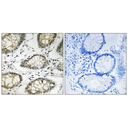 Immunohistochemistry - ATR (Phospho-Ser428) Antibody from Signalway Antibody (12129) - Antibodies.com