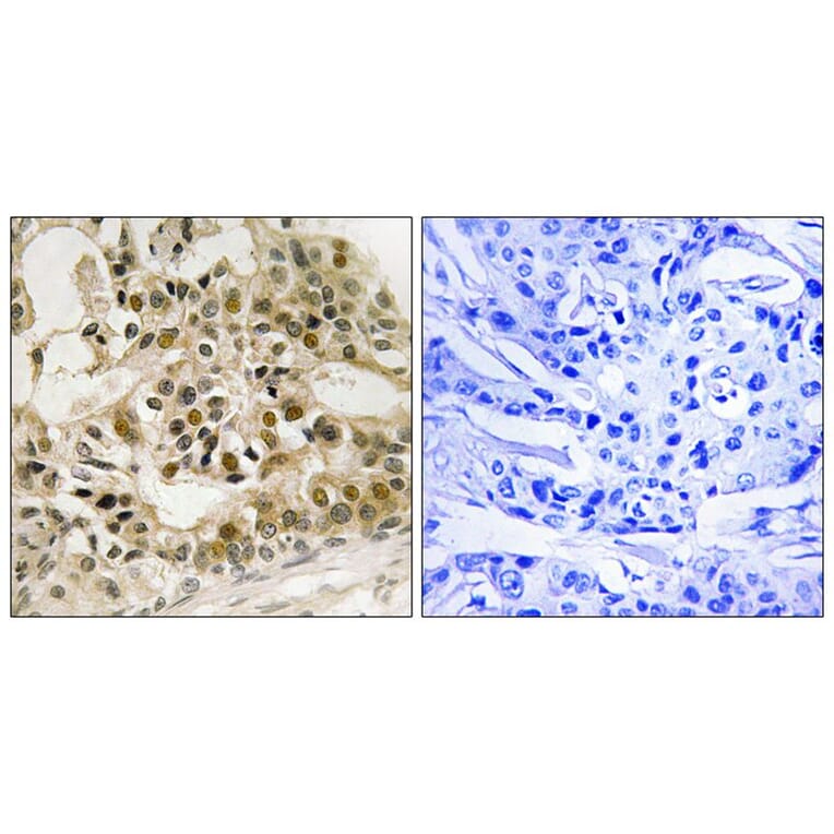 Immunohistochemistry - Myb (Phospho-Ser532) Antibody from Signalway Antibody (12145) - Antibodies.com