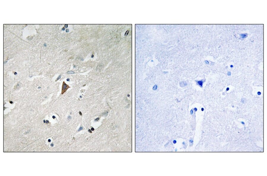 Immunohistochemistry - PDK1 (Phospho-Tyr9) Antibody from Signalway Antibody (11719) - Antibodies.com