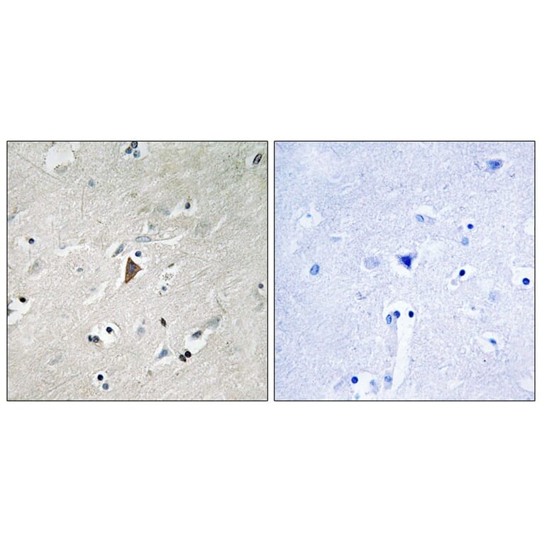 Immunohistochemistry - PDK1 (Phospho-Tyr9) Antibody from Signalway Antibody (11719) - Antibodies.com