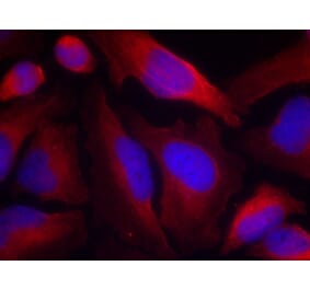 Immunofluorescence - Tyrosine Hydroxylase (Phospho-Ser19) Antibody from Signalway Antibody (11329) - Antibodies.com