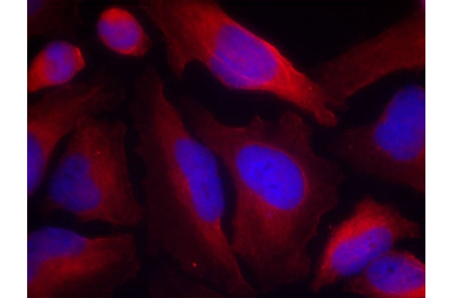 Immunofluorescence - Tyrosine Hydroxylase (Phospho-Ser19) Antibody from Signalway Antibody (11329) - Antibodies.com