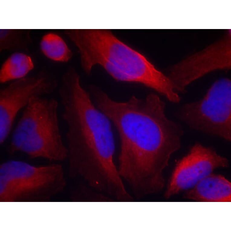 Immunofluorescence - Tyrosine Hydroxylase (Phospho-Ser19) Antibody from Signalway Antibody (11329) - Antibodies.com