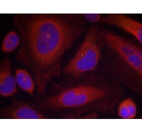 Immunofluorescence - Synaptotagmin 1 (Phospho-Ser309) Antibody from Signalway Antibody (11209) - Antibodies.com