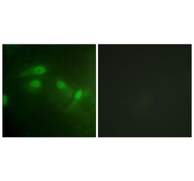 Immunofluorescence - MDM2 (Phospho-Ser186/Ser188) Antibody from Signalway Antibody (11702) - Antibodies.com