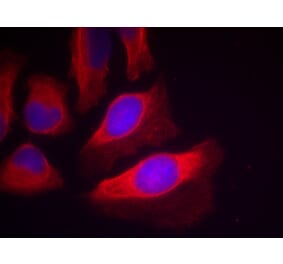 Immunofluorescence - IKK-β (Phospho-Tyr199) Antibody from Signalway Antibody (11305) - Antibodies.com