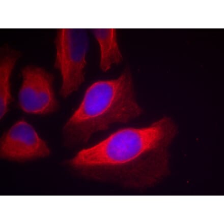 Immunofluorescence - IKK-β (Phospho-Tyr199) Antibody from Signalway Antibody (11305) - Antibodies.com