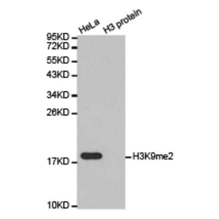 Histone H3K9me2 Polyclonal Antibody from Signalway Antibody (HW005) - Antibodies.com