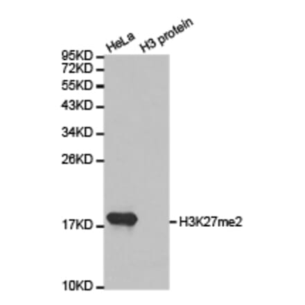 Western blot - Histone H3K27me2 Polyclonal Antibody from Signalway Antibody (HW007) - Antibodies.com