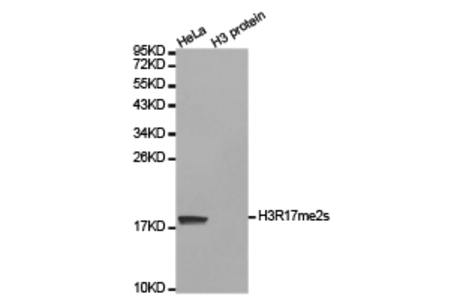 Western blot - Histone H3R17me2s Polyclonal Antibody from Signalway Antibody (HW020) - Antibodies.com