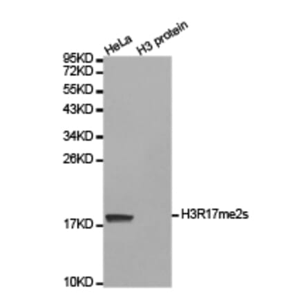 Western blot - Histone H3R17me2s Polyclonal Antibody from Signalway Antibody (HW020) - Antibodies.com