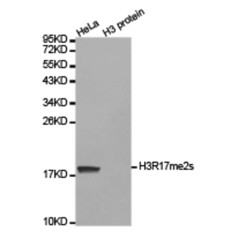 Western blot - Histone H3R17me2s Polyclonal Antibody from Signalway Antibody (HW020) - Antibodies.com