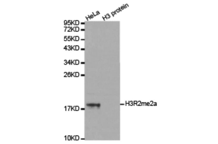 Western blot - Histone H3R2me2a Polyclonal Antibody from Signalway Antibody (HW023) - Antibodies.com