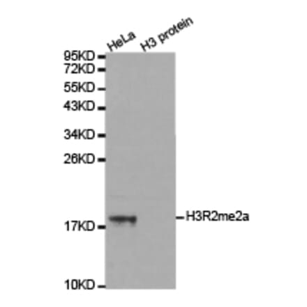 Western blot - Histone H3R2me2a Polyclonal Antibody from Signalway Antibody (HW023) - Antibodies.com