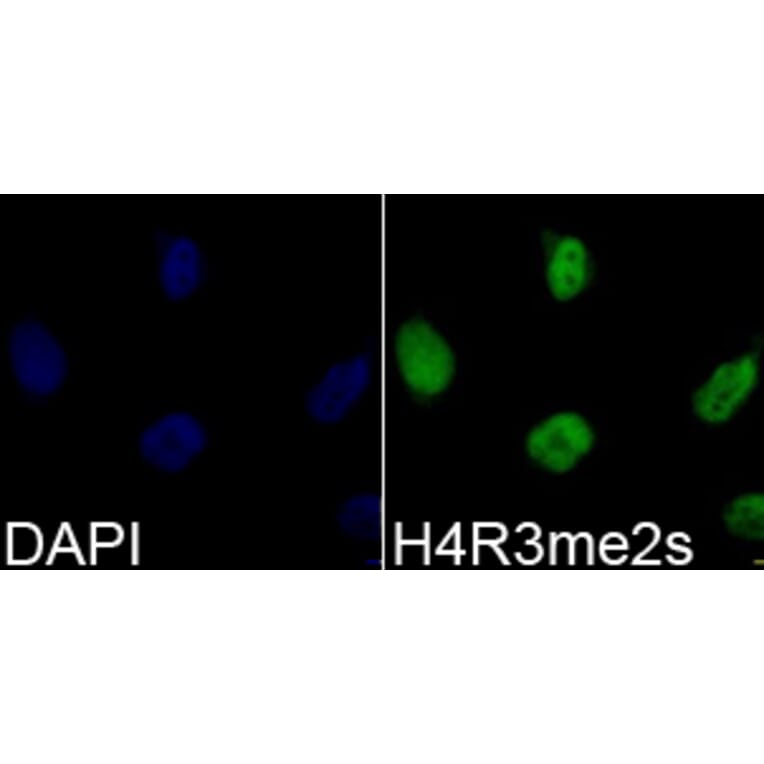 Immunofluorescence - Histone H4R3me2s Polyclonal Antibody from Signalway Antibody (HW027) - Antibodies.com