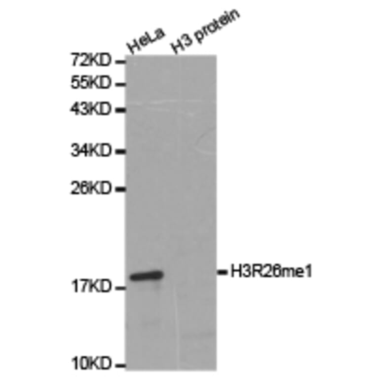 Western blot - Histone H3R26me1 Polyclonal Antibody from Signalway Antibody (HW028) - Antibodies.com