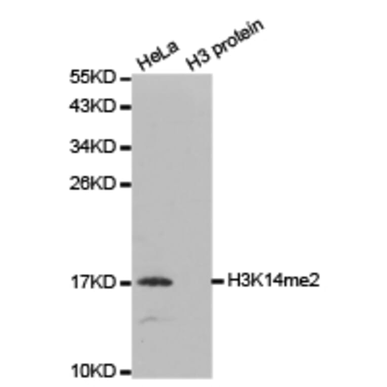 Western blot - Histone H3K14me2 Polyclonal Antibody from Signalway Antibody (HW035) - Antibodies.com
