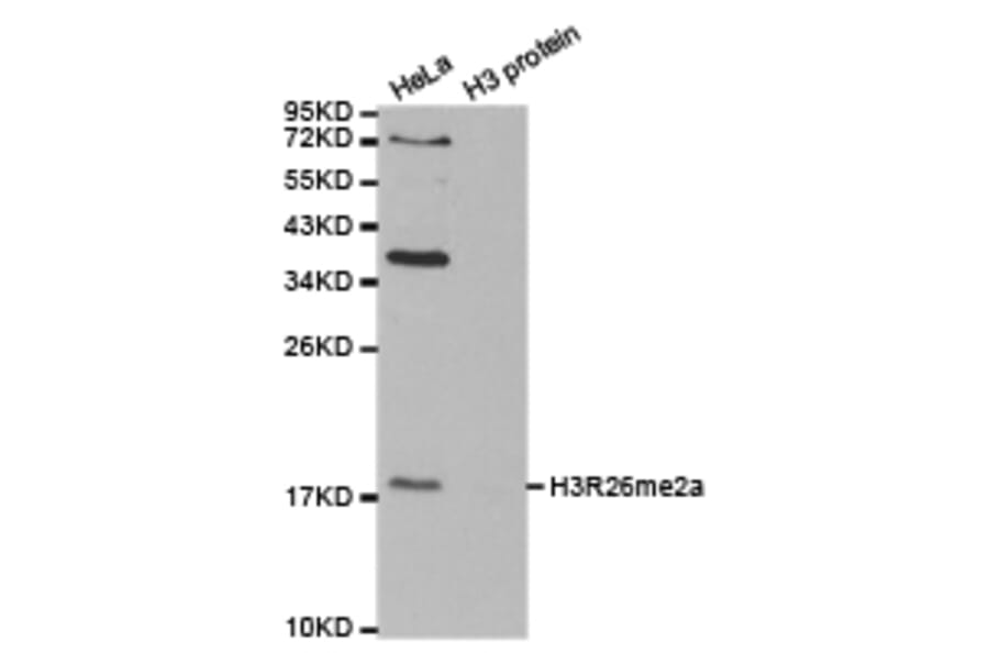 Western blot - Histone H3R26me2a Polyclonal Antibody from Signalway Antibody (HW016) - Antibodies.com