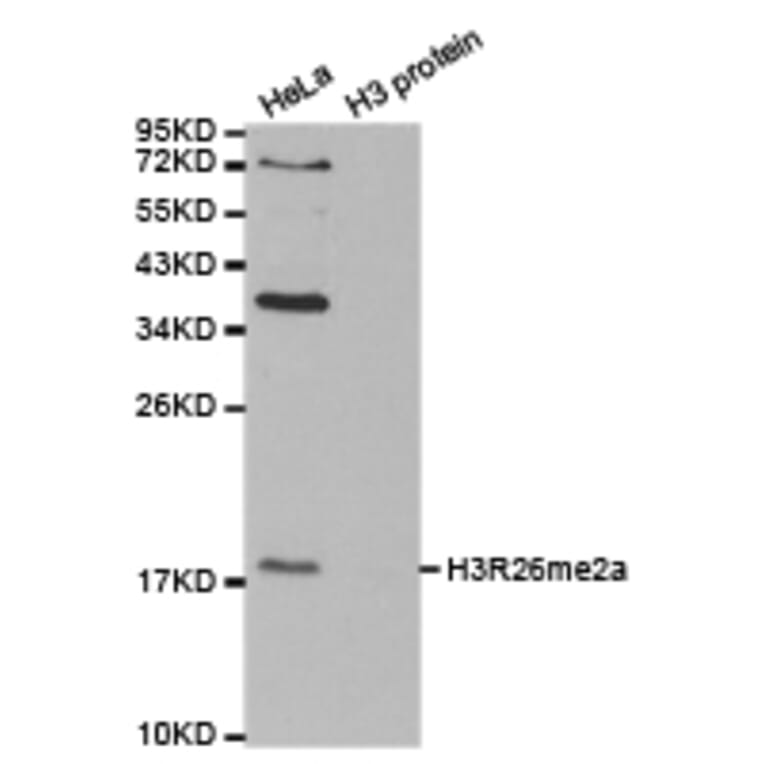 Western blot - Histone H3R26me2a Polyclonal Antibody from Signalway Antibody (HW016) - Antibodies.com