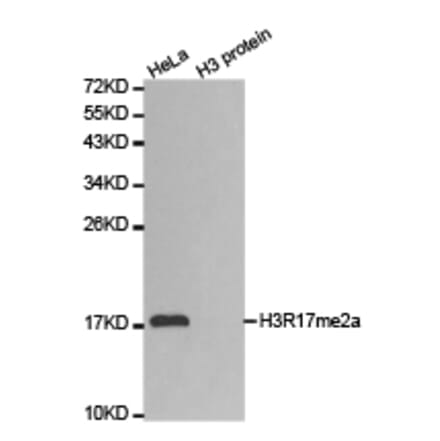 Western blot - Histone H3R17me2a Polyclonal Antibody from Signalway Antibody (HW018) - Antibodies.com