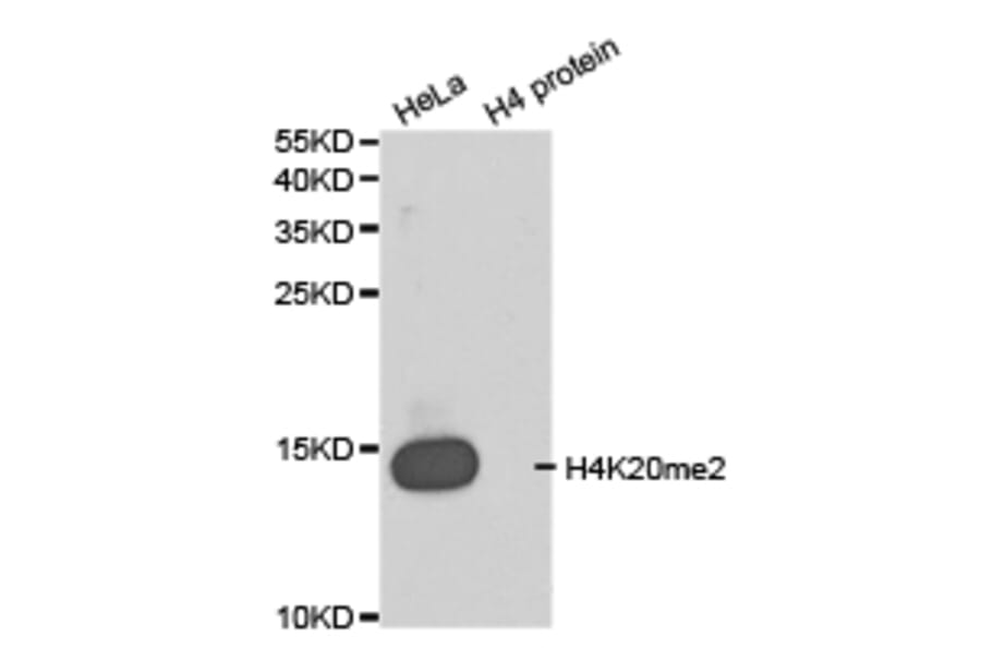 Western blot - Histone H4K20me2 Polyclonal Antibody from Signalway Antibody (HW032) - Antibodies.com