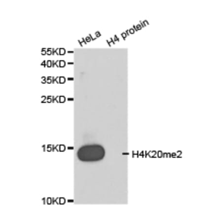 Western blot - Histone H4K20me2 Polyclonal Antibody from Signalway Antibody (HW032) - Antibodies.com