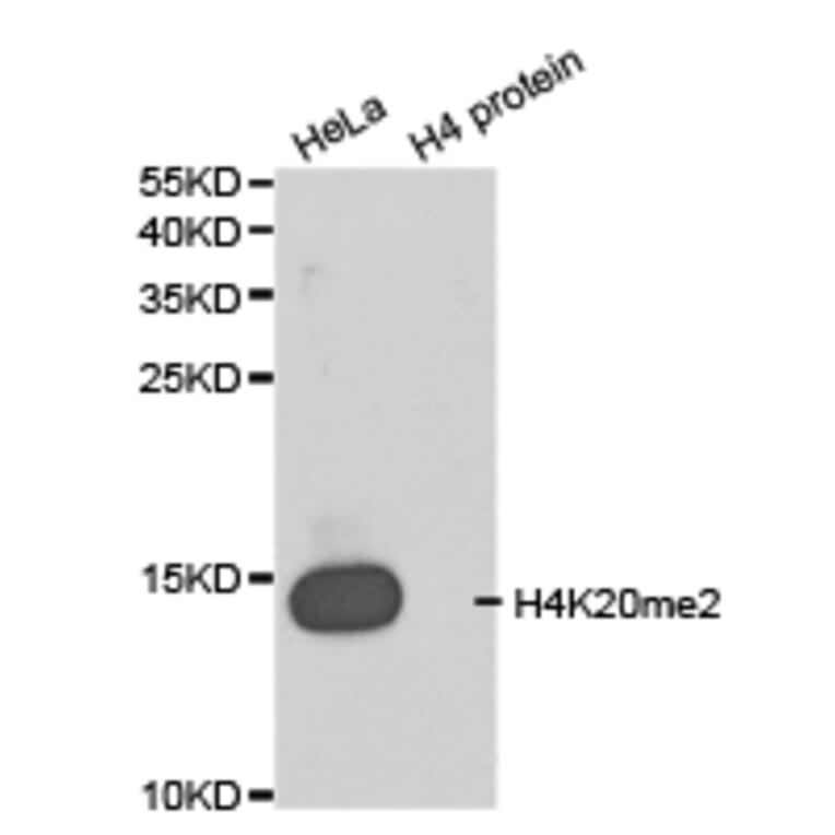 Western blot - Histone H4K20me2 Polyclonal Antibody from Signalway Antibody (HW032) - Antibodies.com