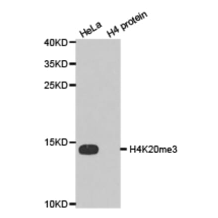 Western blot - Histone H4K20me3 Polyclonal Antibody from Signalway Antibody (HW033) - Antibodies.com