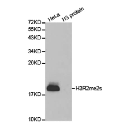 Western blot - Histone H3R2me2s Polyclonal Antibody from Signalway Antibody (HW014) - Antibodies.com