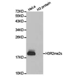 Western blot - Histone H3R2me2s Polyclonal Antibody from Signalway Antibody (HW014) - Antibodies.com